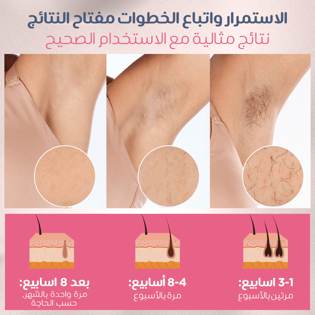 🔥 لاسوفت برو لإزالة الشعر نهائيا